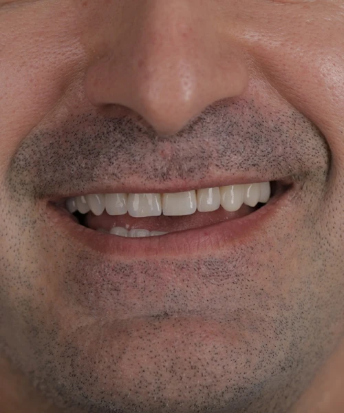 Radu