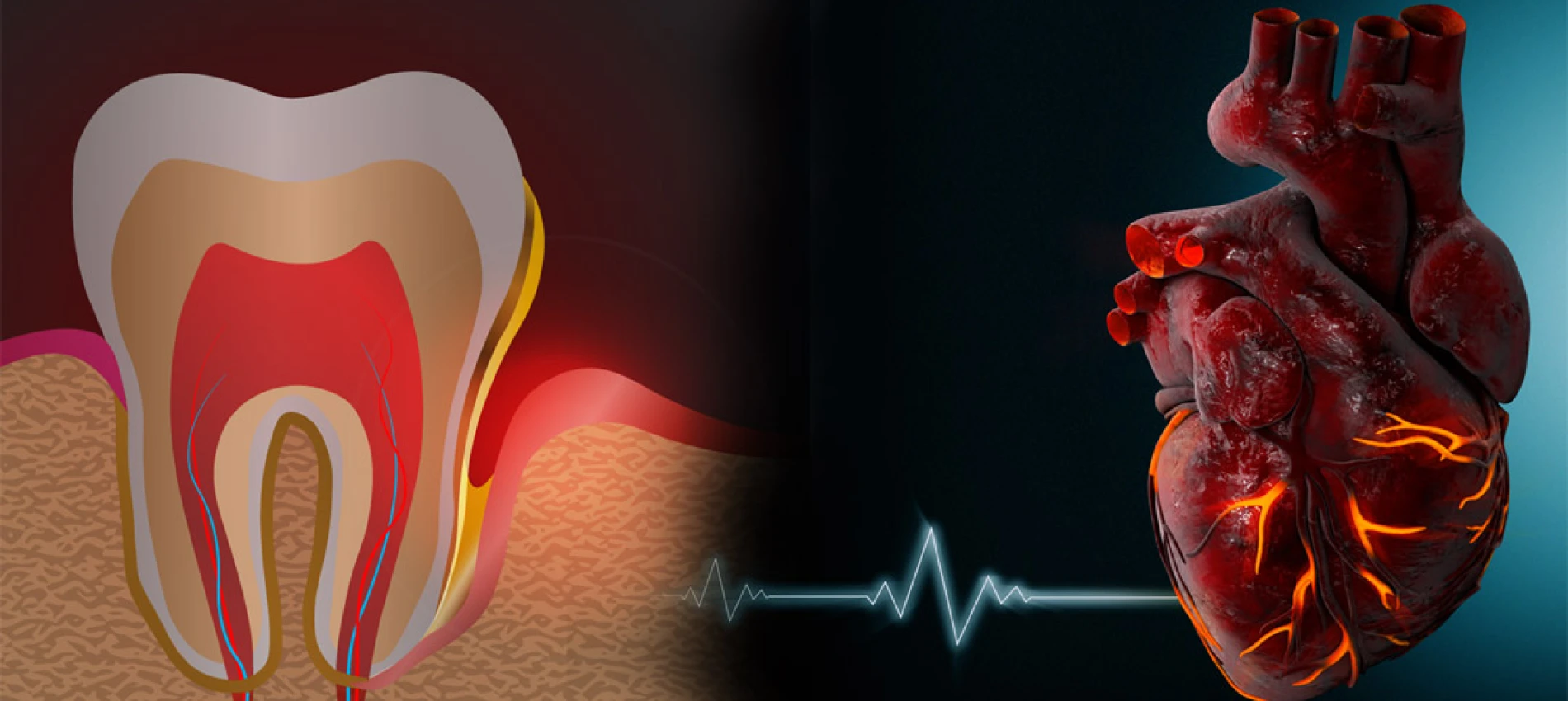 Parodontoza și inima: există o legătură între sănătatea gingiilor și sănătatea cardiovasculară?