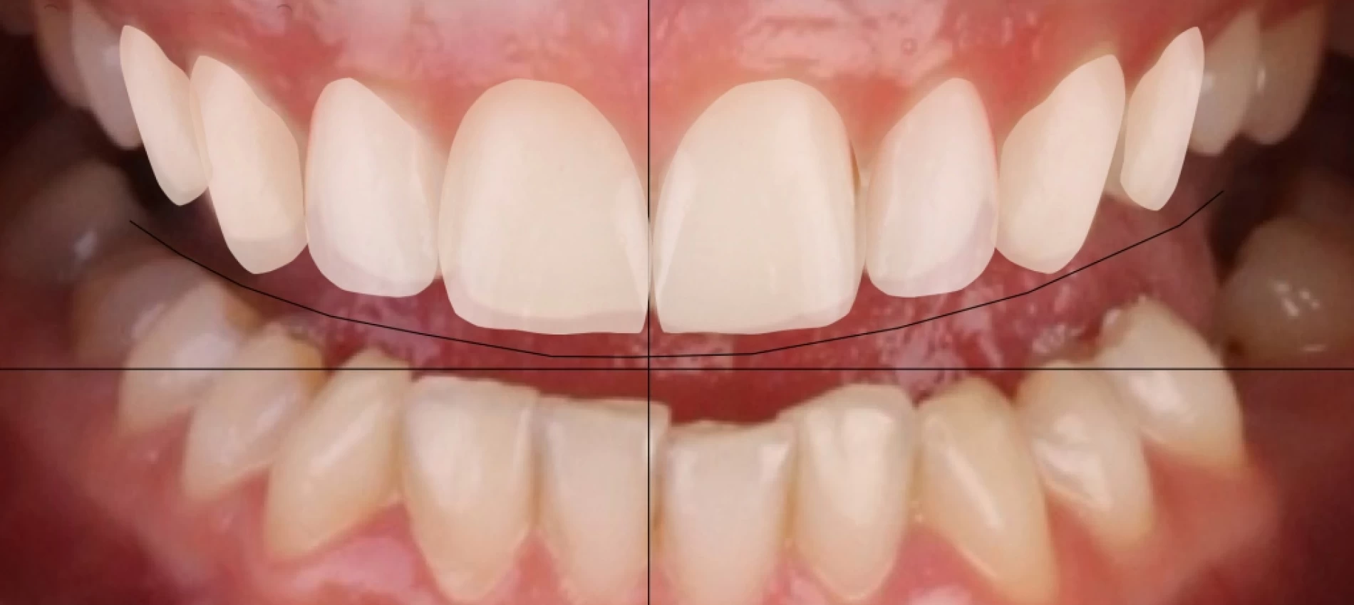 Digital Smile Design, Perfectionare continua NeoClinique