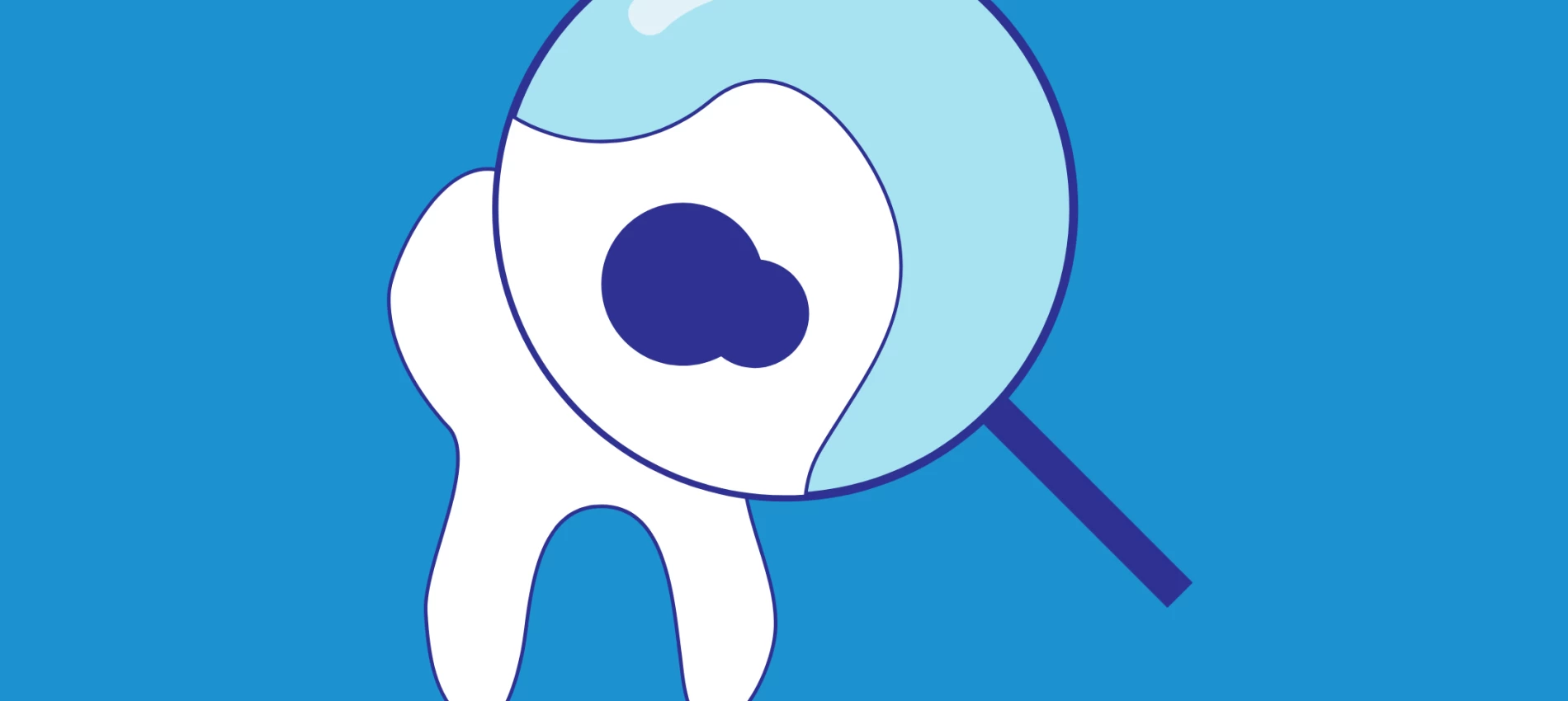 Ce este caria dentara si cum putem preveni aparitia ei