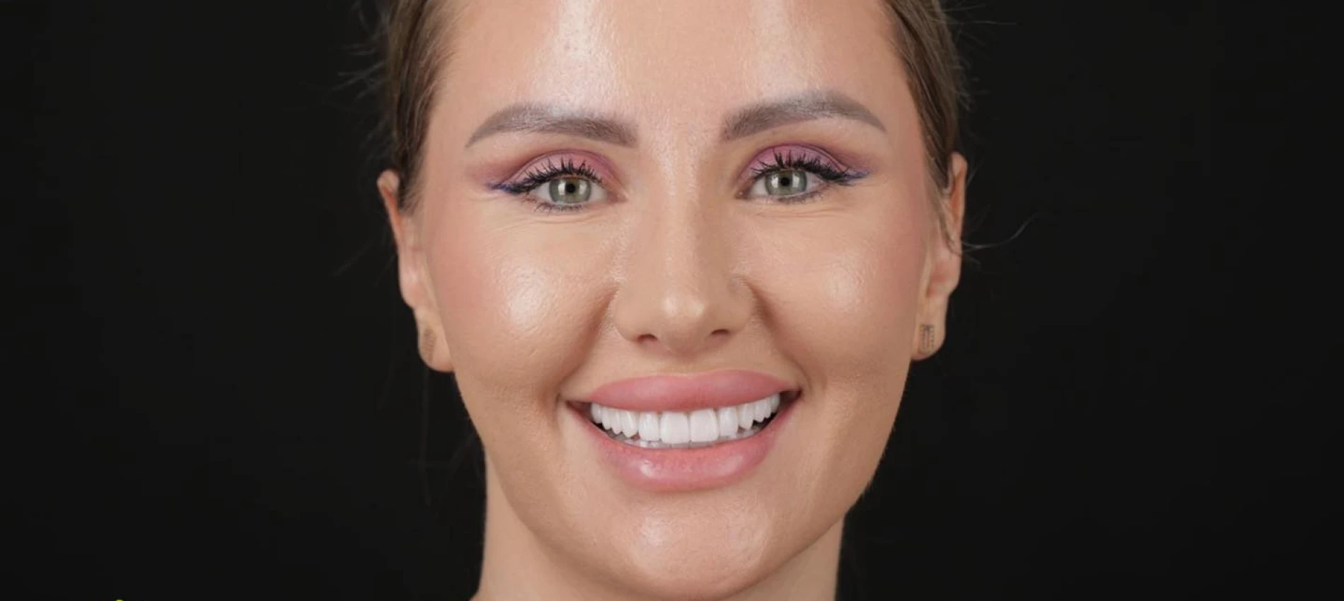 De ce estetica dentară începe cu sănătatea, nu cu forma