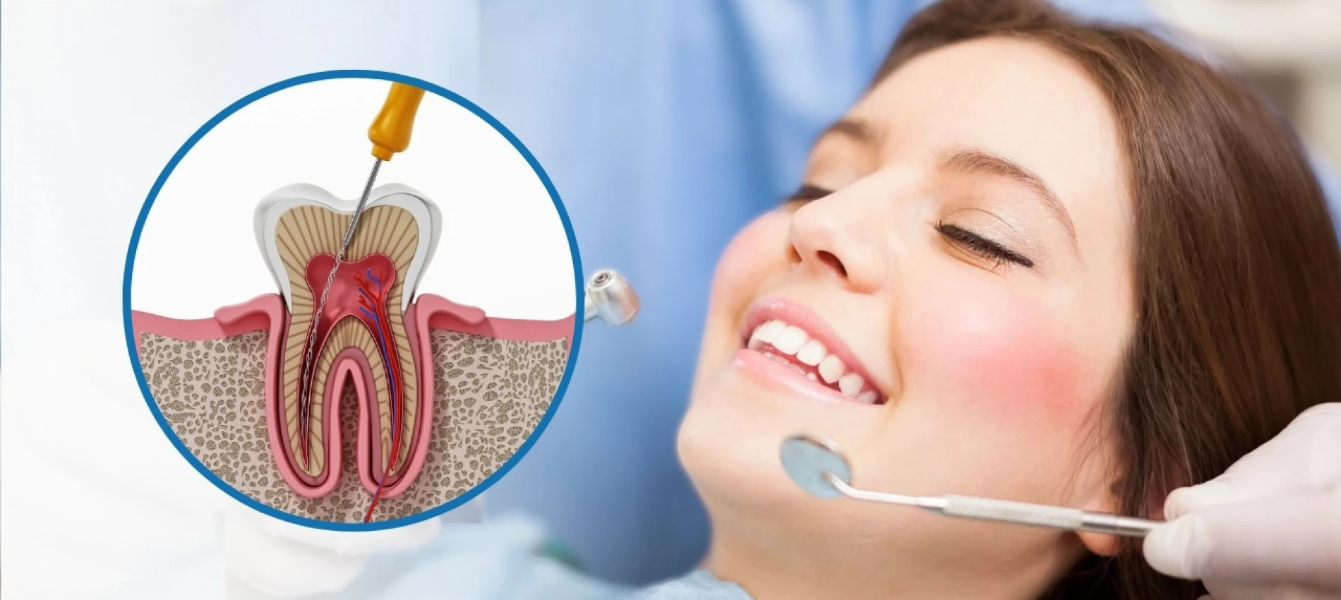 Semnele că ai nevoie urgent de un tratament endodontic