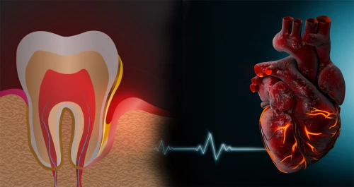 Parodontoza și inima: există o legătură între sănătatea gingiilor și sănătatea cardiovasculară?