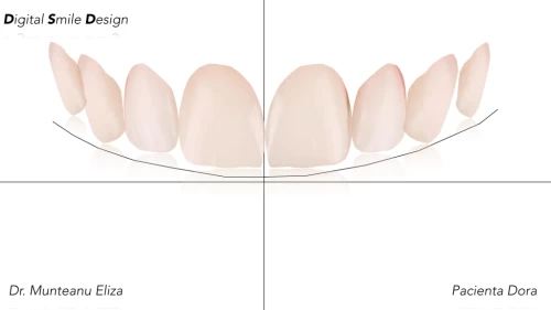 Digital Smile Design (DSD)