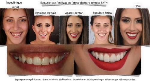 Estetică dentară în timp real,  inovație stomatologică la Neoclinique