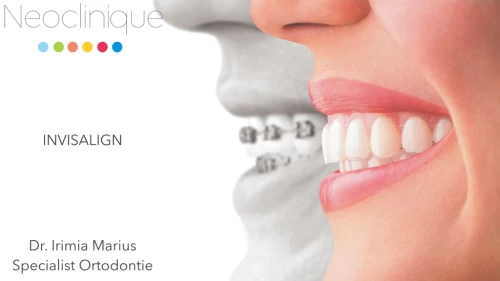 Tipuri de Aparate Ortodontice - Dr. Irimia Marius, Specialist Ortodontie