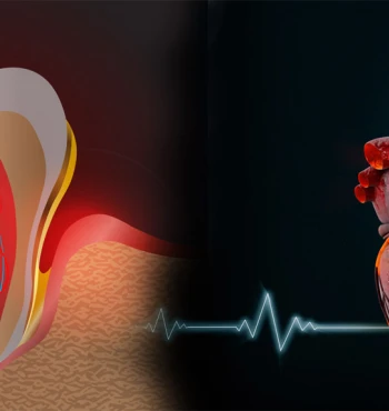 Parodontoza și inima: există o legătură între sănătatea gingiilor și sănătatea cardiovasculară?
