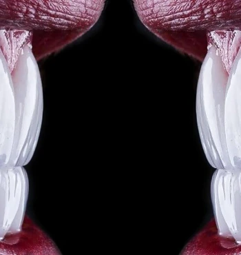 Fatete ceramice versus fatete din compozit