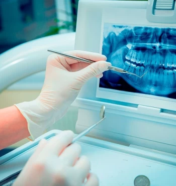 Radiografia dentara este periculoasa ?