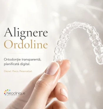 Alignere Ordoline București | Alignere transparente | Neoclinique