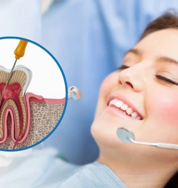 Semnele că ai nevoie urgent de un tratament endodontic