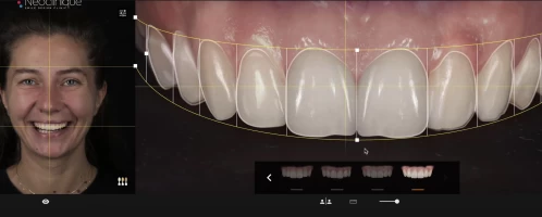 Digital Smile Design