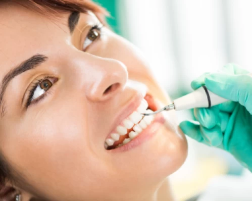 Igienizare dentară